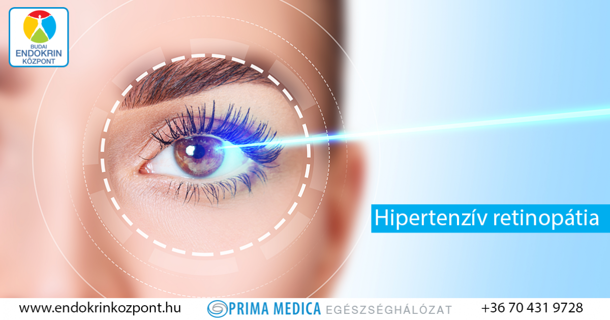 a szem artériák hipertóniája szűkül