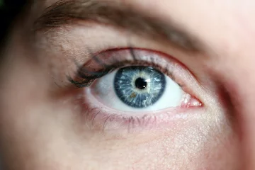 Szürkehályog- az idősödő szem gyakori problémája