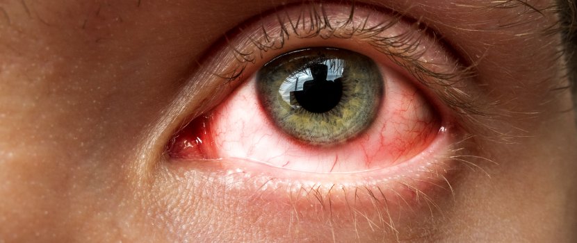 szem betegség a cukorbetegség kezelésére